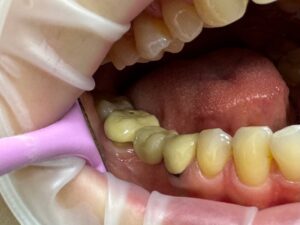 Стоматолог ортопед в Тольятти