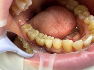 Стоматолог ортопед в Тольятти